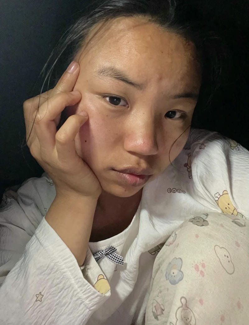 ảnh gái xấu 32