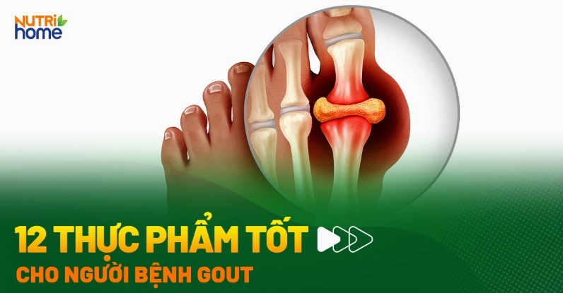Bệnh gout nên ăn gì: 12 thực phẩm cho người bị gút tốt nhất