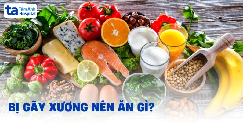bị gãy xương nên ăn gì