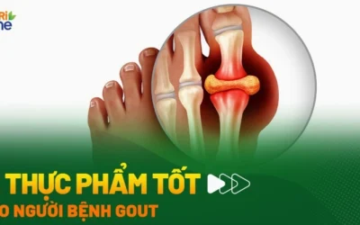 Bị gout nên ăn gì? Chế độ dinh dưỡng chuẩn để kiểm soát Acid Uric