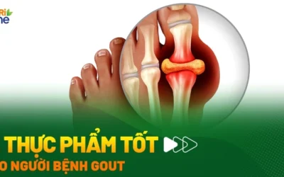 Bị gút nên ăn gì để giảm đau nhanh và kiểm soát acid uric hiệu quả?
