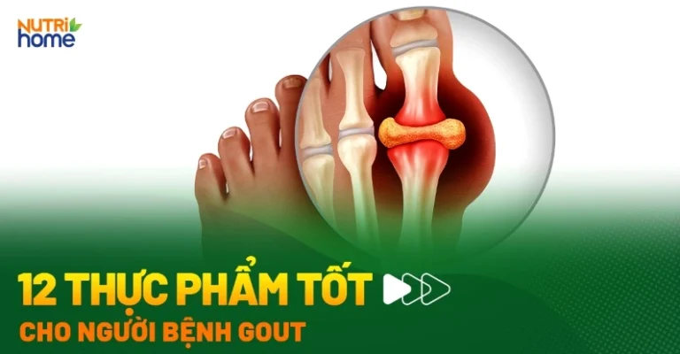 Bị gút nên ăn gì để giảm đau nhanh và kiểm soát acid uric hiệu quả?