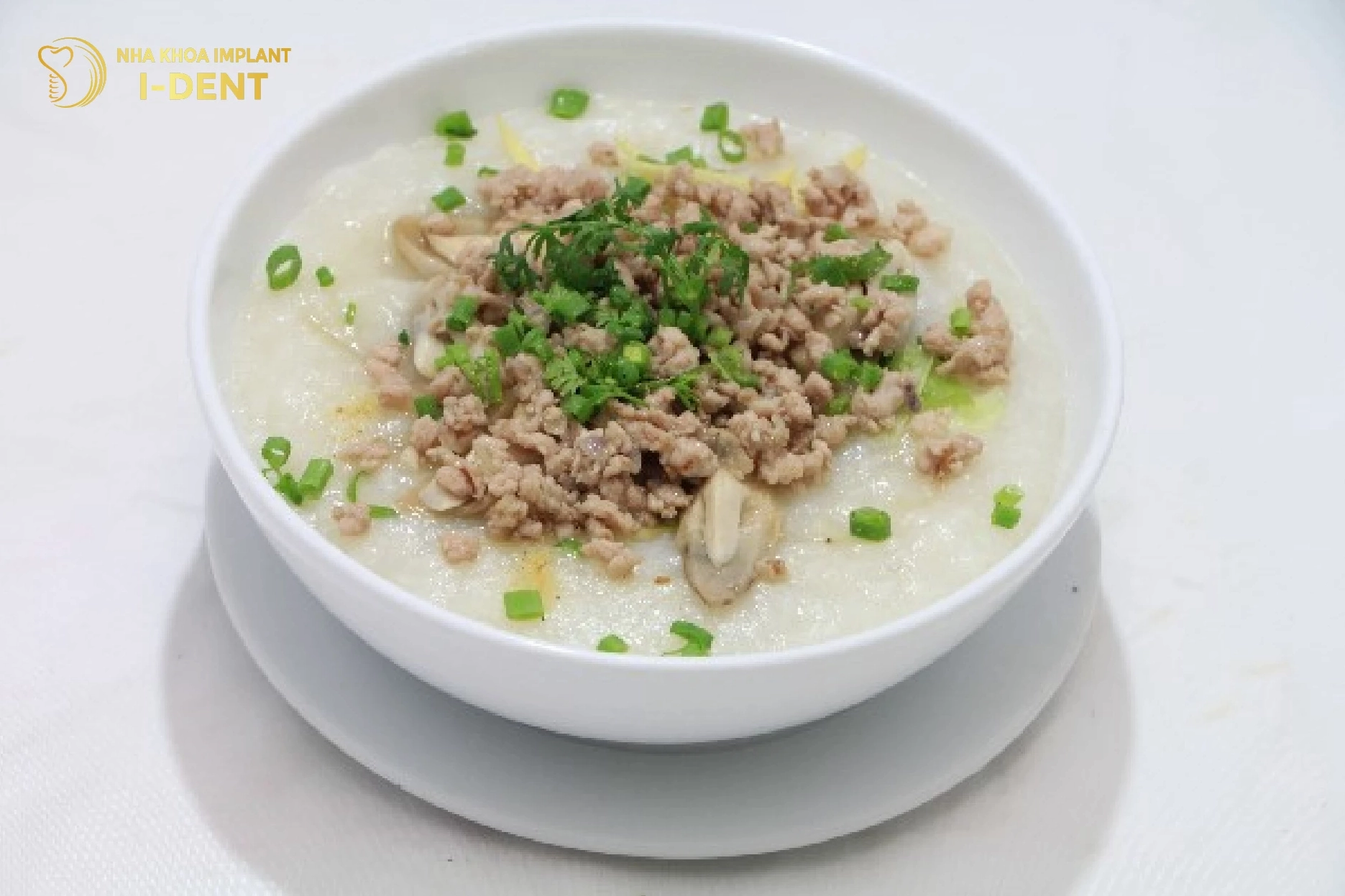 Các món cháo súp bún phở là những đồ ăn mềm dễ nhai khi đeo niềng