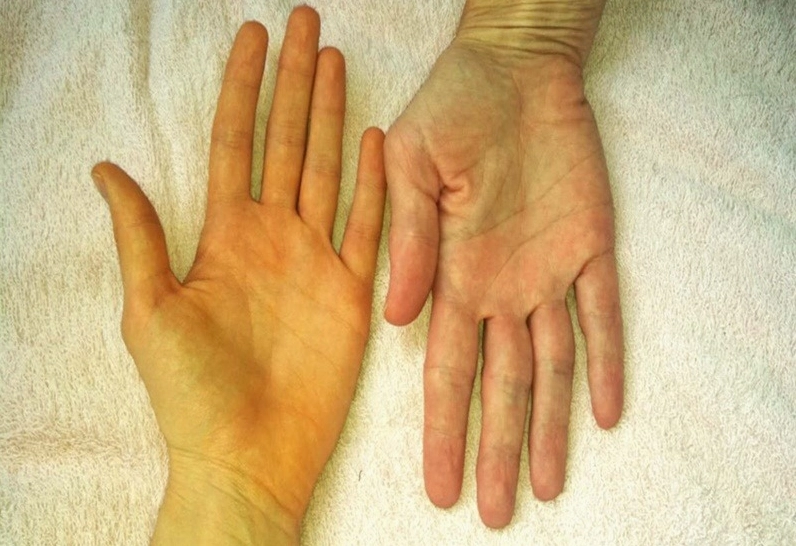 Đối tượng nào không nên ăn đu đủ chín 2