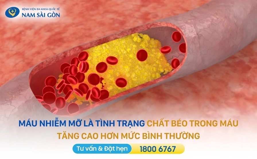 Giải đáp thắc mắc máu nhiễm mỡ nên ăn gì