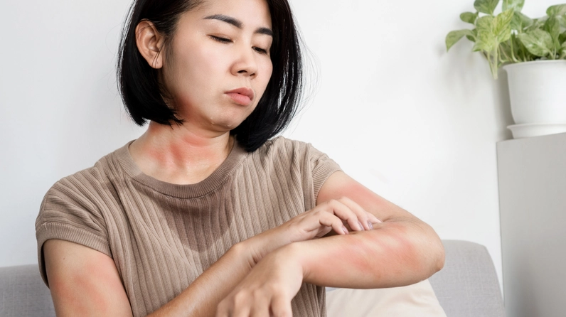 Một số nhóm người nên hạn chế hạt hạnh nhân