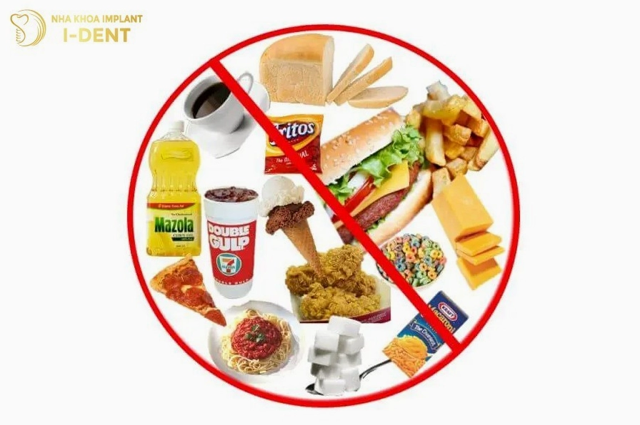 Nên đeo hàm duy trì để giữ kết quả niềng răng dài lâu