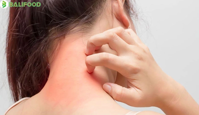 Người bị dị ứng với các loại hạt cây cần tránh ăn hạt mắc ca