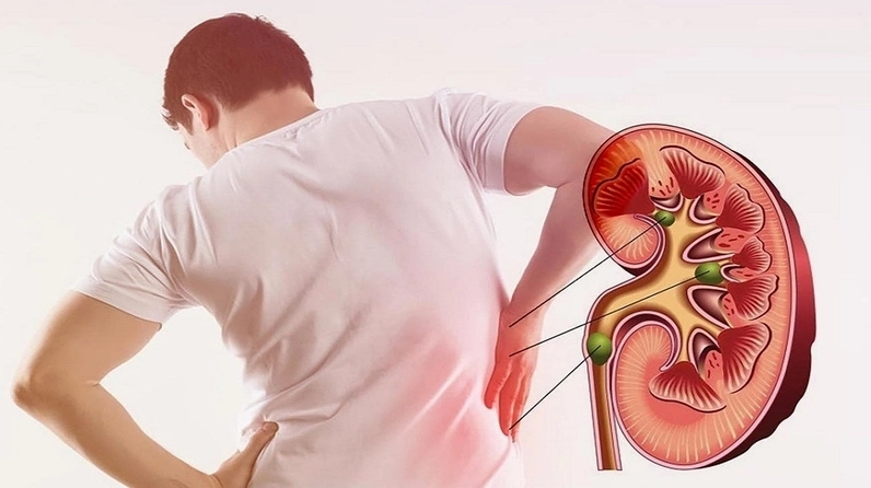 Những ai không nên ăn tỏi đen để tránh phản tác dụng? 4
