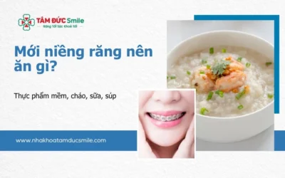 Niềng răng nên ăn gì? Thực đơn dinh dưỡng khoa học cho người niềng răng