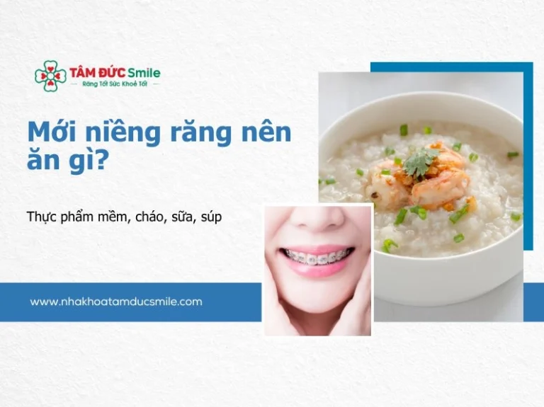 Niềng răng nên ăn gì? Thực đơn dinh dưỡng khoa học cho người niềng răng