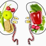 Sỏi thận nên ăn gì? Chế độ dinh dưỡng khoa học để ngăn ngừa tái phát