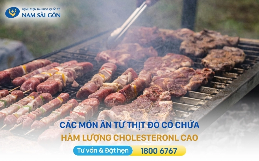 Thịt đỏ chứa nhiều cholesterol cần hạn chế
