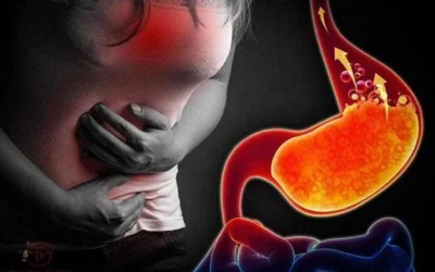 Trào ngược dạ dày nên ăn gì để giảm nhanh triệu chứng? Hướng dẫn 2026
