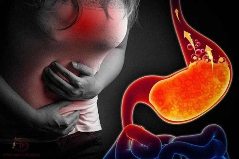 Trào ngược dạ dày nên ăn gì để giảm nhanh triệu chứng? Hướng dẫn 2026