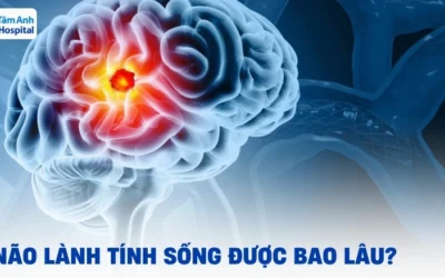 U Não Lành Tính Sống Được Bao Lâu? Yếu Tố Ảnh Hưởng & Tiên Lượng 2026