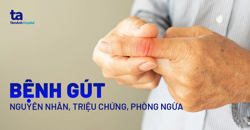Bệnh gút: Nguyên nhân, triệu chứng, chẩn đoán