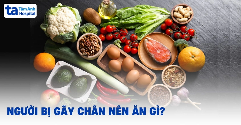 Bị gãy chân nên ăn gì để mau lành?