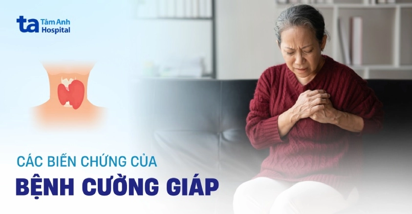 Các biến chứng nguy hiểm của cường giáp