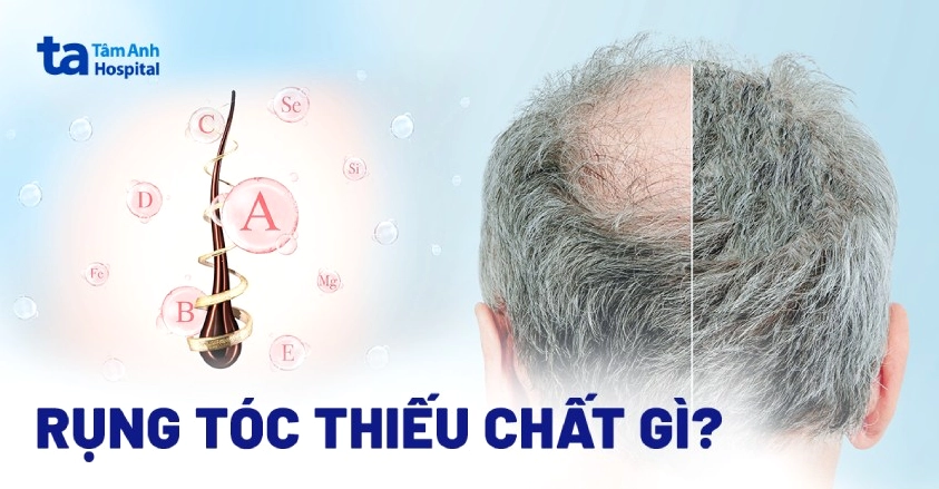 Các loại thực phẩm giàu vitamin và khoáng chất tốt cho tóc
