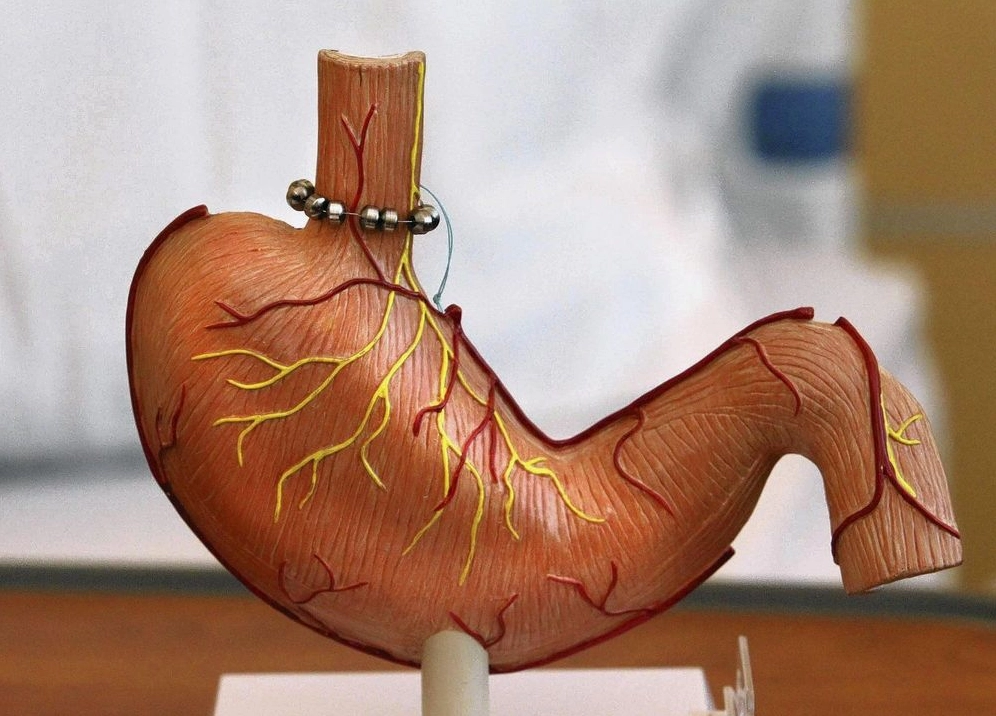 Cảm giác đắng miệng có thể do trào ngược dạ dày