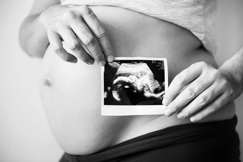 Có nhiều nguyên nhân gây dị tật ở thai nhi