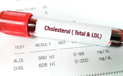LDL Cholesterol Cao: Ăn Gì Tốt, Kiêng Gì Để Bảo Vệ Tim Mạch