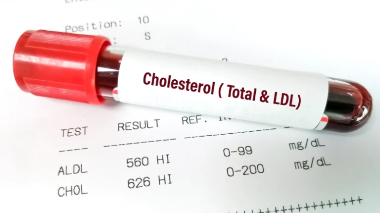 LDL Cholesterol Cao: Ăn Gì Tốt, Kiêng Gì Để Bảo Vệ Tim Mạch