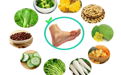 Người Bị Gout Nên Ăn Gì? Cẩm Nang Toàn Diện Từ A-Z 2026