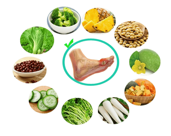 Người Bị Gout Nên Ăn Gì? Cẩm Nang Toàn Diện Từ A-Z 2026