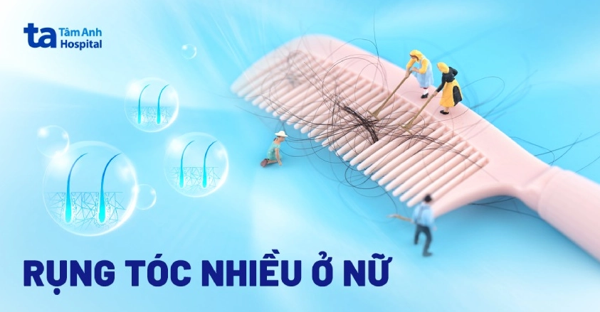 Nguyên nhân và cách giảm rụng tóc ở nữ giới