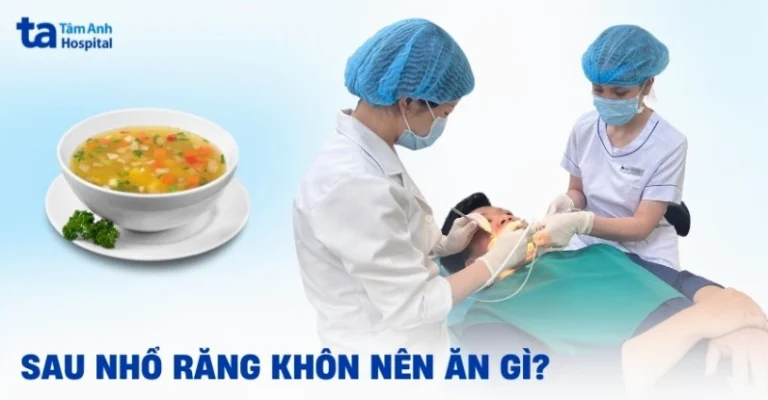 Nhổ Răng Khôn Nên Ăn Gì? Bí Quyết Phục Hồi Nhanh Chóng 2026
