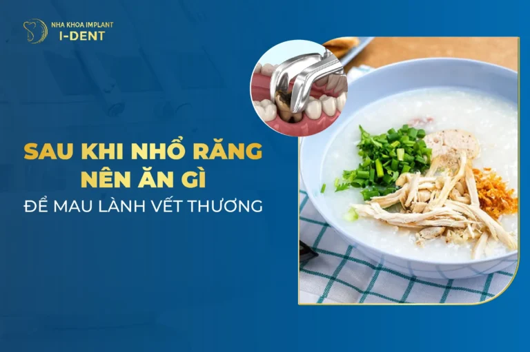 Nhổ Răng Xong Nên Ăn Gì 2026? Thực Đơn Phục Hồi Nhanh Chóng