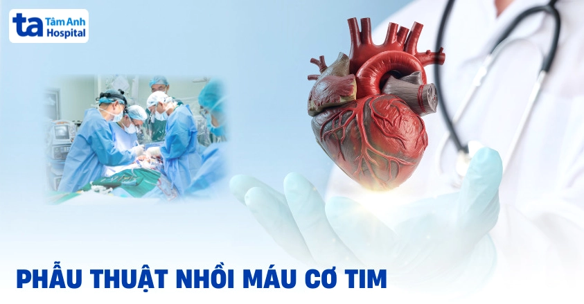 Phẫu thuật nhồi máu cơ tim cấp