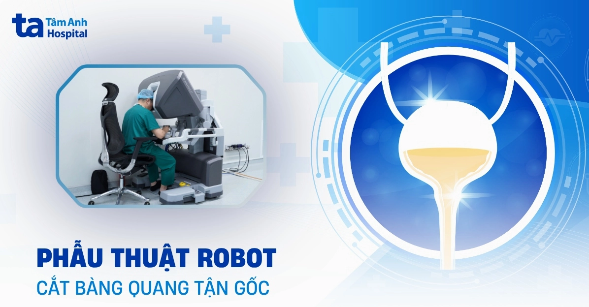 Phẫu thuật robot hỗ trợ điều trị bệnh thận