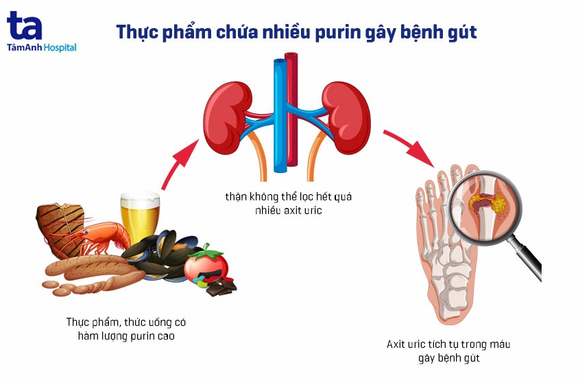 Thực phẩm chứa nhiều purin