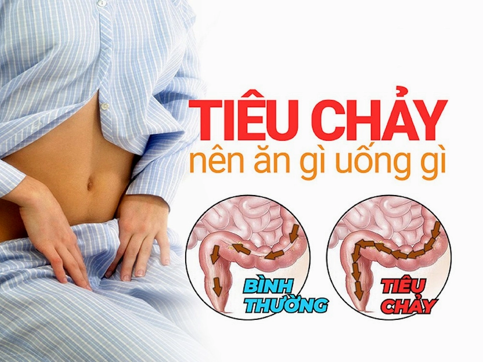 Tiêu chảy ăn gì để nhanh hồi phục là thắc mắc của nhiều người.