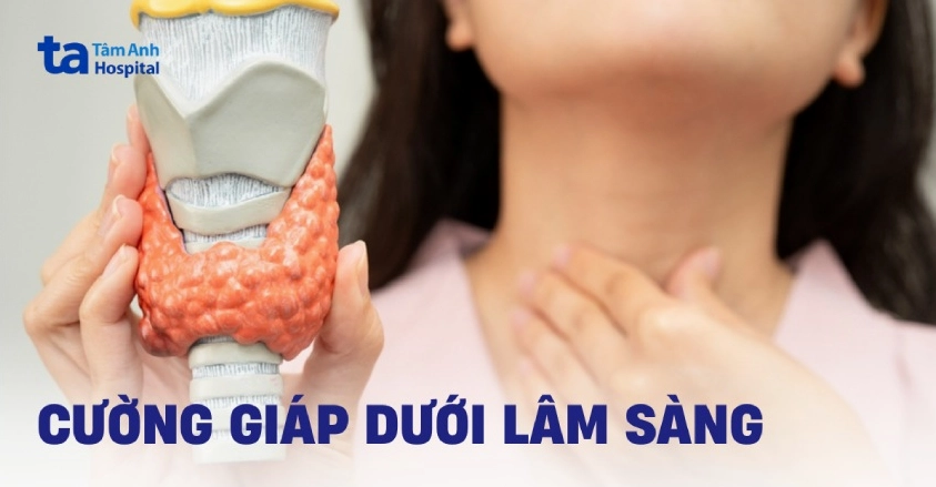 Tìm hiểu về cường giáp dưới lâm sàng
