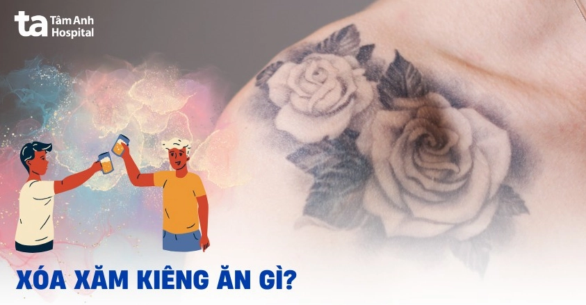 Tránh ăn đồ nếp và hải sản sau khi xăm