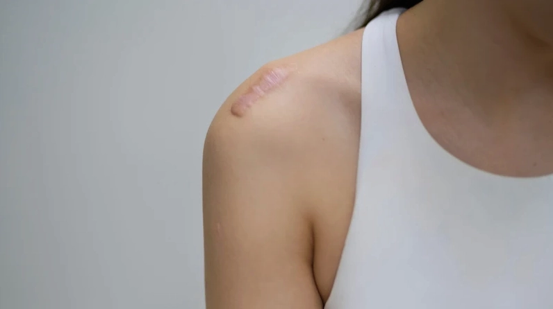 Vết thương hở kiêng ăn gì​ để nhanh lành? 3