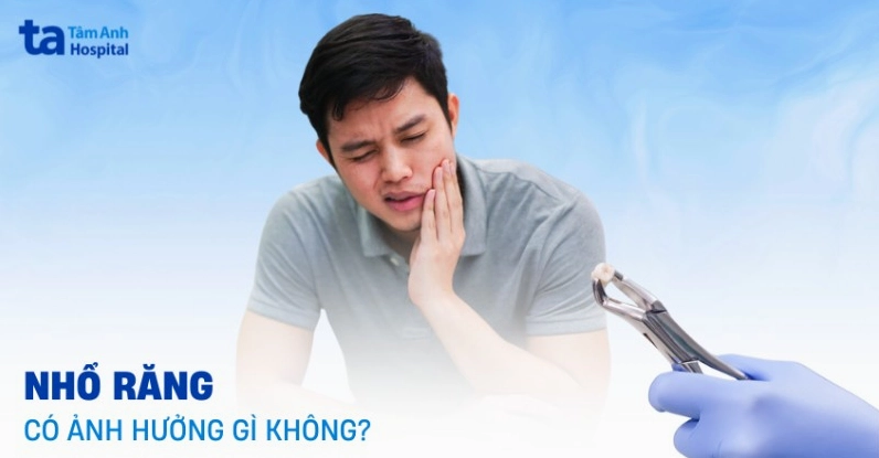 Vết thương sau nhổ răng cần được chăm sóc cẩn thận