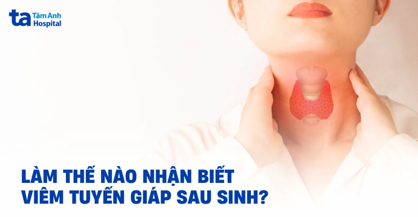 Viêm tuyến giáp sau sinh