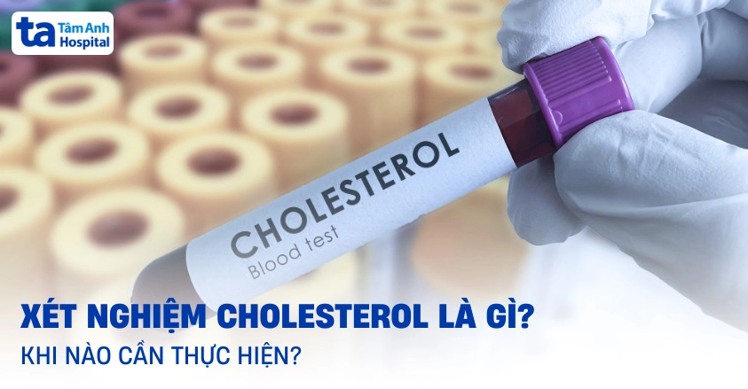 Xét nghiệm cholesterol là gì? Quy trình và ý nghĩa kiểm tra